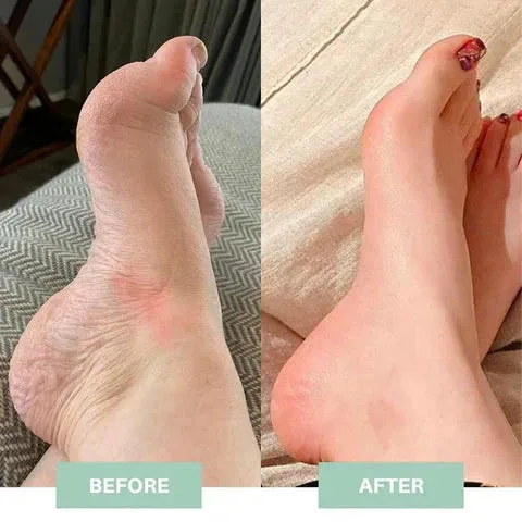 Careovate Female Sex Toys EMS Foot Massager